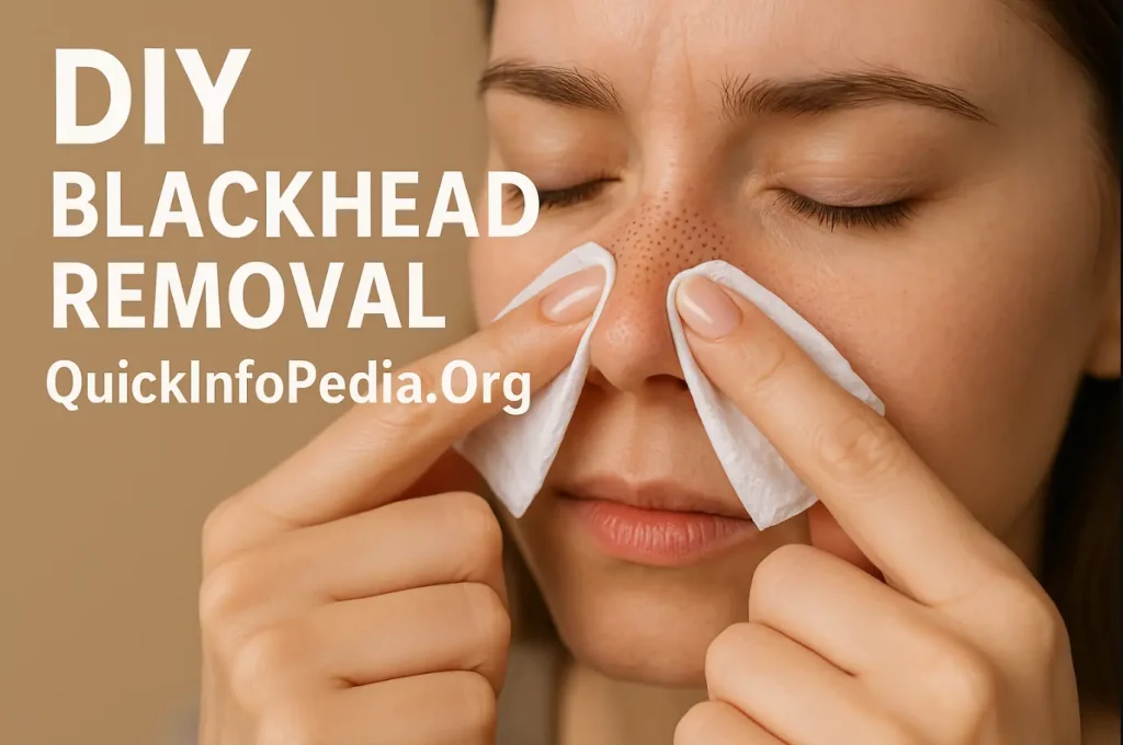 natural ways to remove blackheads