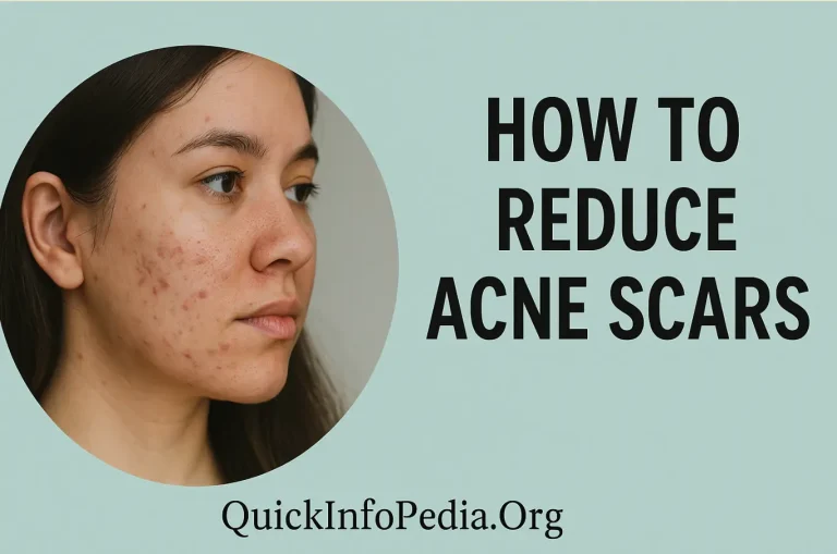 acne scar treatment